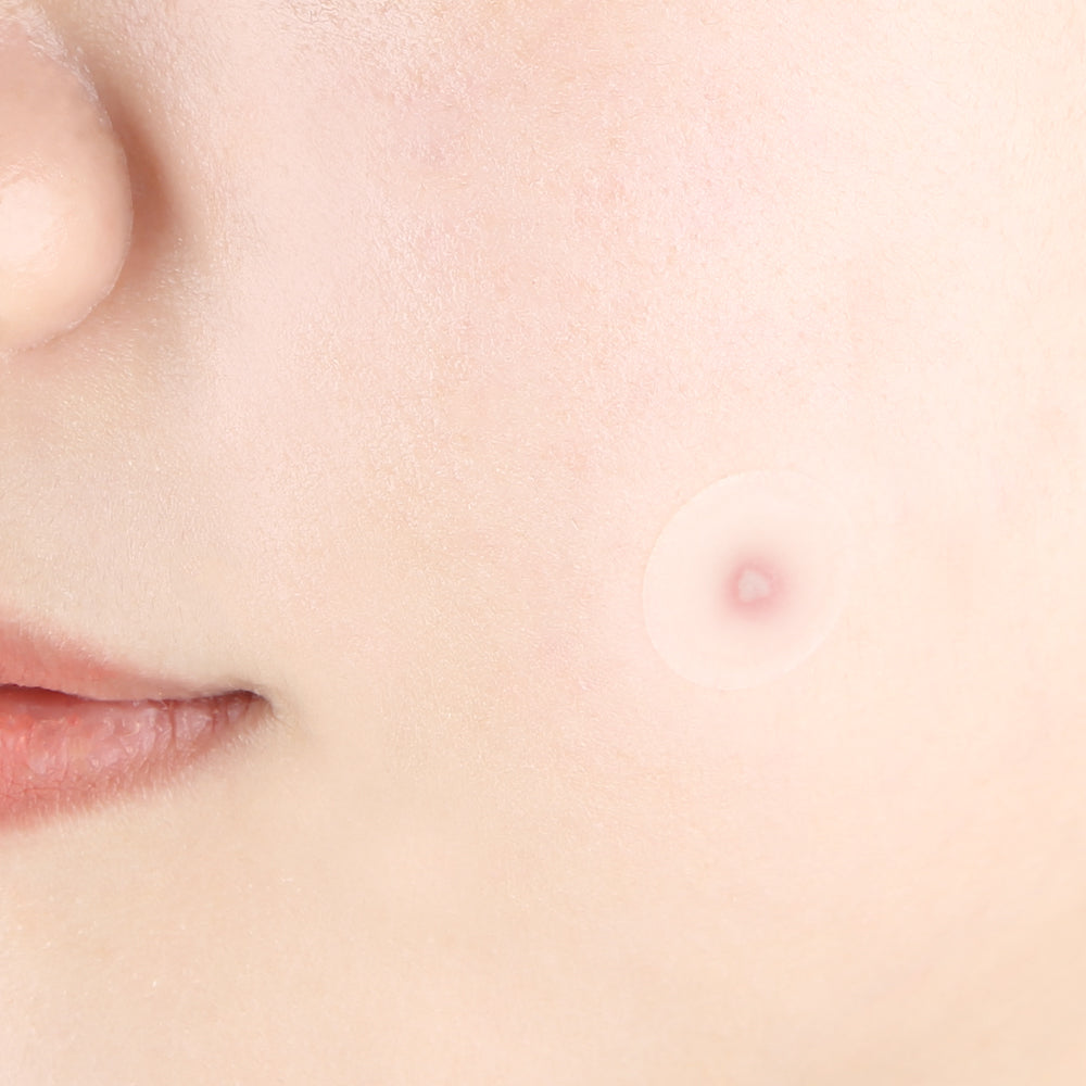 [PyunkangYul] Clear Spot Patch 72ea