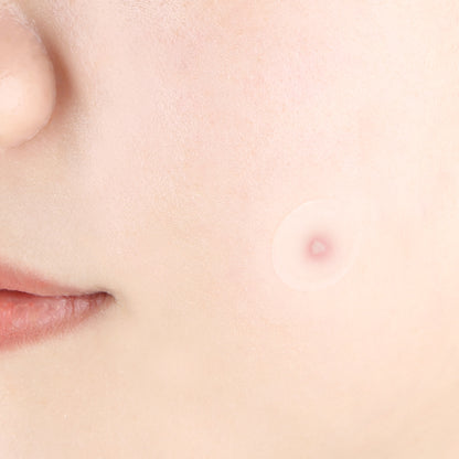 [PyunkangYul] Clear Spot Patch 72ea