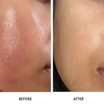 [iUNIK] Tea Tree Relief Serum 50ml